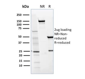 SDS-PAGE - Anti-CD36 Antibody [GPIIIb/1654] (A250688) - Antibodies.com