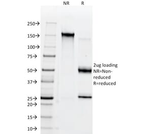 SDS-PAGE - Anti-CD38 Antibody [AT1] (A250690) - Antibodies.com