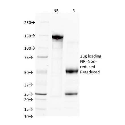 SDS-PAGE - Anti-CD38 Antibody [FS02] (A250691) - Antibodies.com