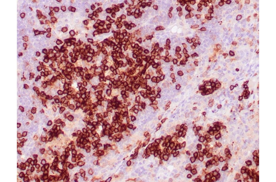 Immunohistochemistry - Anti-CD38 Antibody [CD38/4328] (A250694) - Antibodies.com