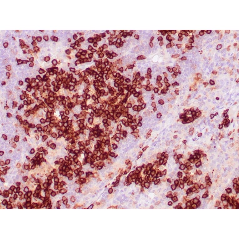 Immunohistochemistry - Anti-CD38 Antibody [CD38/4328] (A250694) - Antibodies.com