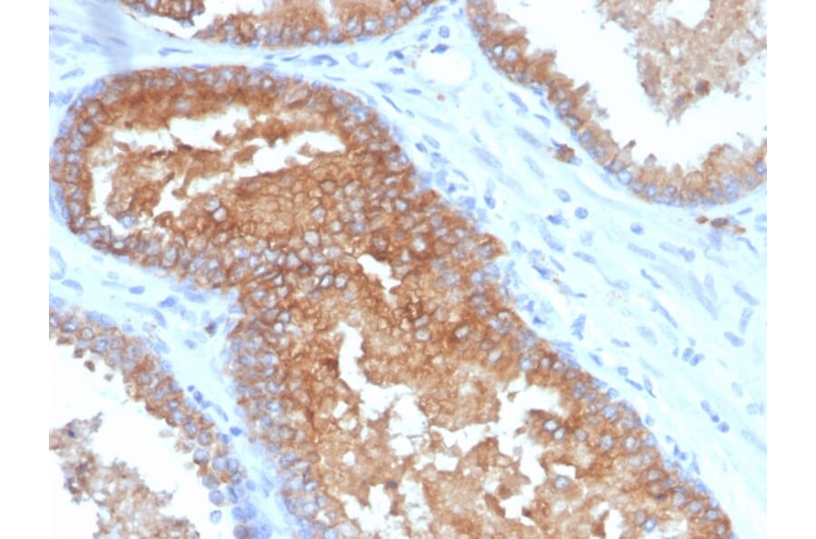 Immunohistochemistry - Anti-CD38 Antibody [CD38/4328] (A250694) - Antibodies.com