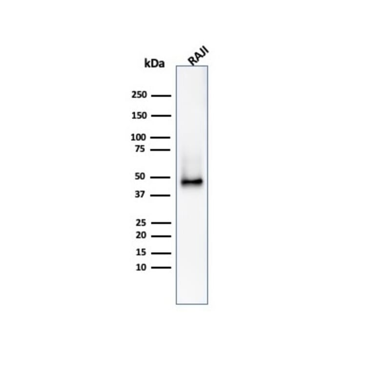 Western Blot - Anti-CD38 Antibody [CD38/4328] (A250694) - Antibodies.com