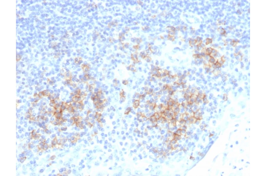 Immunohistochemistry - Anti-CD38 Antibody [CD38/4328] (A250694) - Antibodies.com