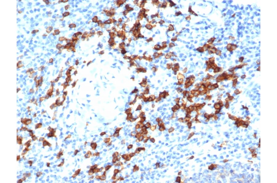 Immunohistochemistry - Anti-CD38 Antibody [rCD38/6447] (A250694) - Antibodies.com