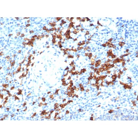 Immunohistochemistry - Anti-CD38 Antibody [rCD38/6447] (A250694) - Antibodies.com