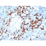 Immunohistochemistry - Anti-CD38 Antibody [rCD38/6447] (A250694) - Antibodies.com