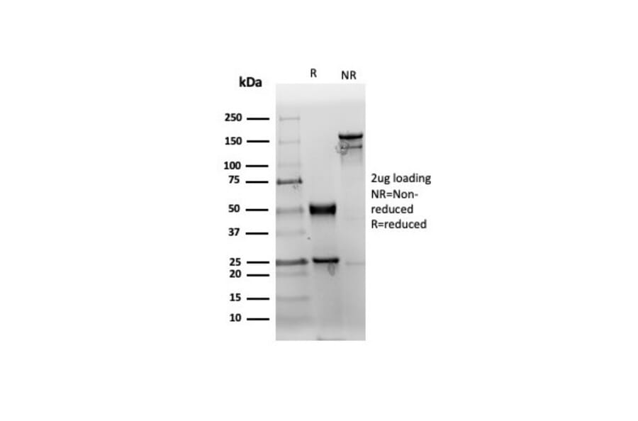SDS-PAGE - Anti-CD38 Antibody [rCD38/6447] (A250695) - Antibodies.com