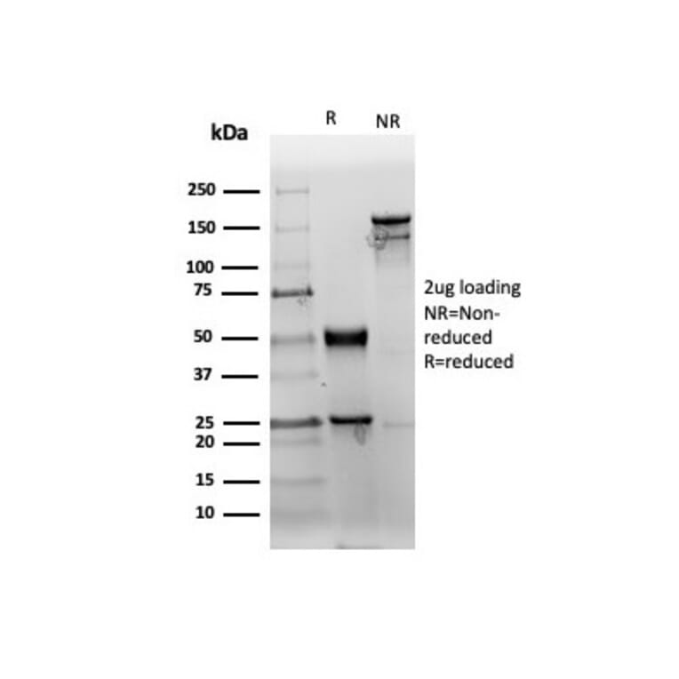 SDS-PAGE - Anti-CD38 Antibody [rCD38/6447] (A250695) - Antibodies.com