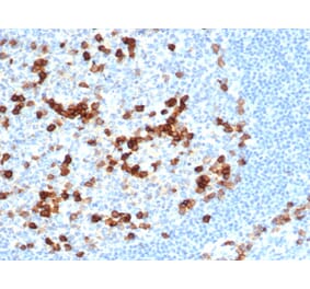Immunohistochemistry - Anti-CD38 Antibody [CD38/6448R] (A250695) - Antibodies.com