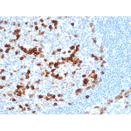 Immunohistochemistry - Anti-CD38 Antibody [CD38/6448R] (A250695) - Antibodies.com