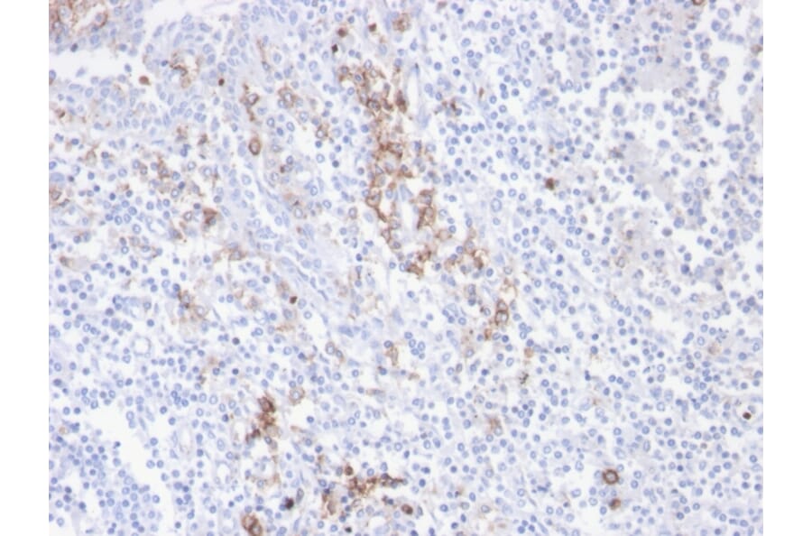Immunohistochemistry - Anti-CD38 Antibody [CD38/4247R] (A250696) - Antibodies.com