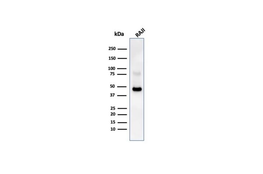 Western Blot - Anti-CD38 Antibody [CD38/4247R] (A250697) - Antibodies.com