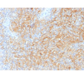 Immunohistochemistry - Anti-CD40 Antibody [C40/1605] (A250698) - Antibodies.com