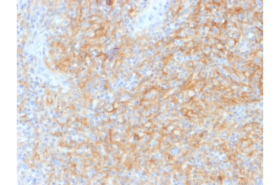 Immunohistochemistry - Anti-CD40 Antibody [C40/1605] (A250698) - Antibodies.com