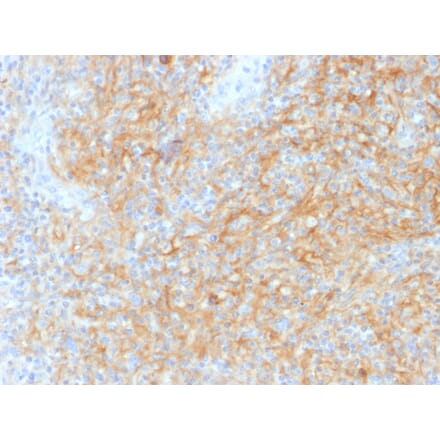 Immunohistochemistry - Anti-CD40 Antibody [C40/1605] (A250698) - Antibodies.com