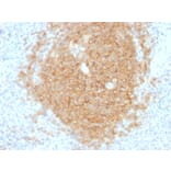 Immunohistochemistry - Anti-CD40 Antibody [C40/1605] (A250698) - Antibodies.com