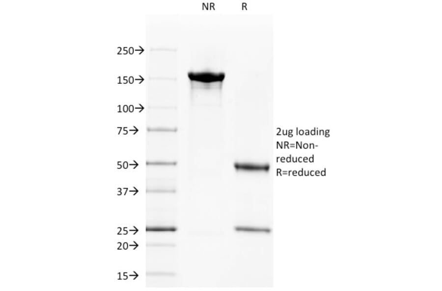SDS-PAGE - Anti-CD40 Antibody [C40/1605] (A250698) - Antibodies.com