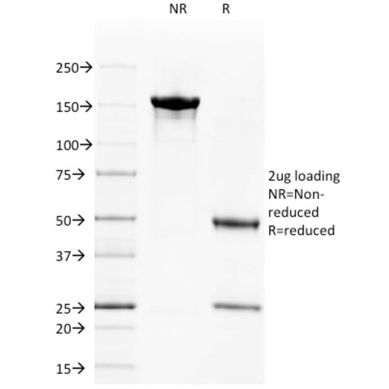 SDS-PAGE - Anti-CD40 Antibody [C40/1605] (A250698) - Antibodies.com