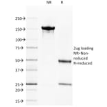 SDS-PAGE - Anti-CD40 Antibody [C40/1605] (A250698) - Antibodies.com