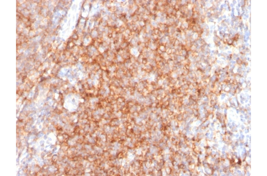 Immunohistochemistry - Anti-CD40 Antibody [C40/2383] (A250700) - Antibodies.com