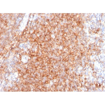 Immunohistochemistry - Anti-CD40 Antibody [C40/2383] (A250700) - Antibodies.com