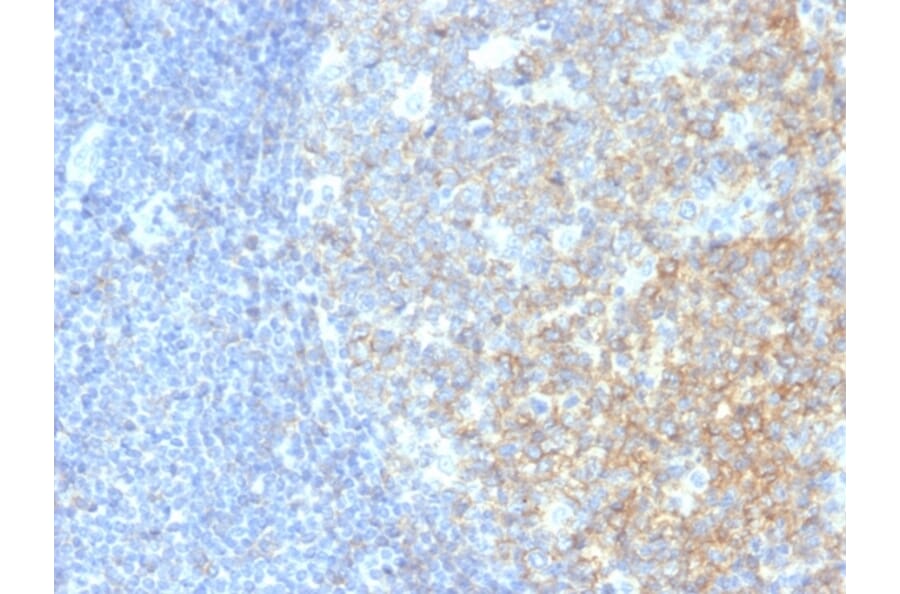 Immunohistochemistry - Anti-CD40 Antibody [C40/2383] (A250700) - Antibodies.com