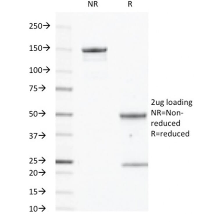 SDS-PAGE - Anti-CD40 Antibody [C40/2383] (A250700) - Antibodies.com