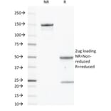SDS-PAGE - Anti-CD40 Antibody [C40/2383] (A250700) - Antibodies.com