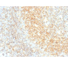 Immunohistochemistry - Anti-CD40 Antibody [C40/4826R] (A250701) - Antibodies.com