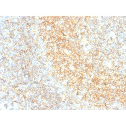 Immunohistochemistry - Anti-CD40 Antibody [C40/4826R] (A250701) - Antibodies.com