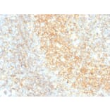 Immunohistochemistry - Anti-CD40 Antibody [C40/4826R] (A250701) - Antibodies.com