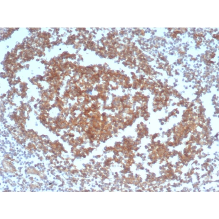 Immunohistochemistry - Anti-CD40 Antibody [C40/4826R] (A250700) - Antibodies.com