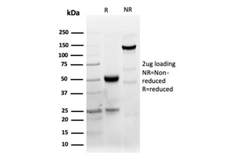 SDS-PAGE - Anti-CD40 Antibody [C40/4826R] (A250701) - Antibodies.com