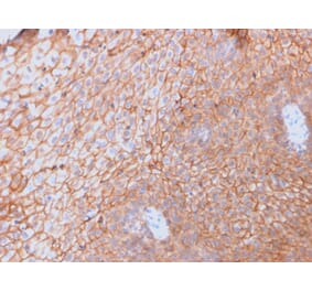 Immunohistochemistry - Anti-CD40L Antibody [CD40LG/2761] (A250702) - Antibodies.com
