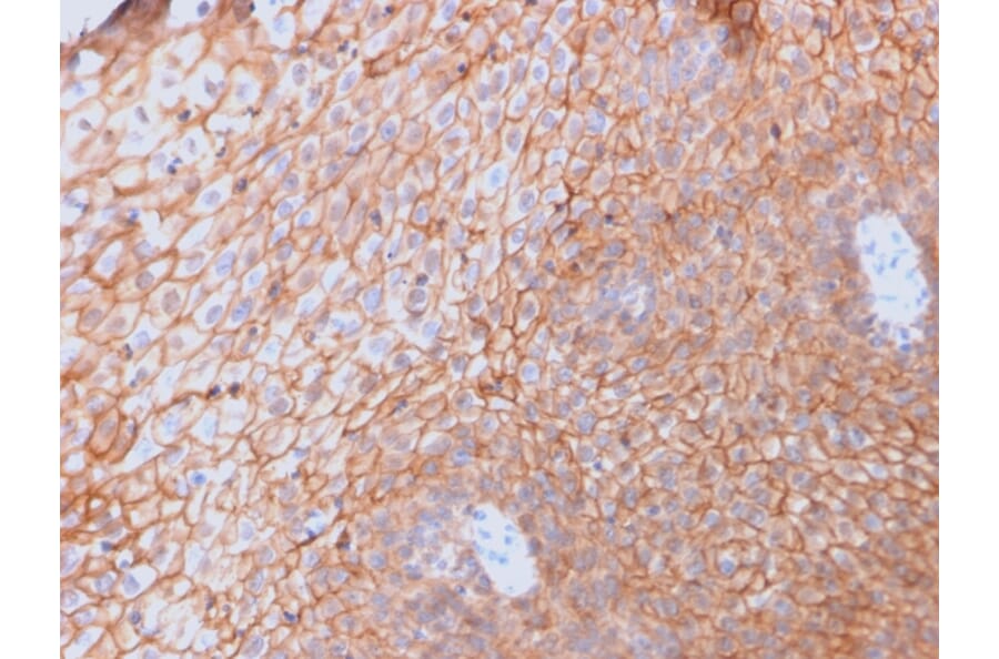 Immunohistochemistry - Anti-CD40L Antibody [CD40LG/2761] (A250702) - Antibodies.com