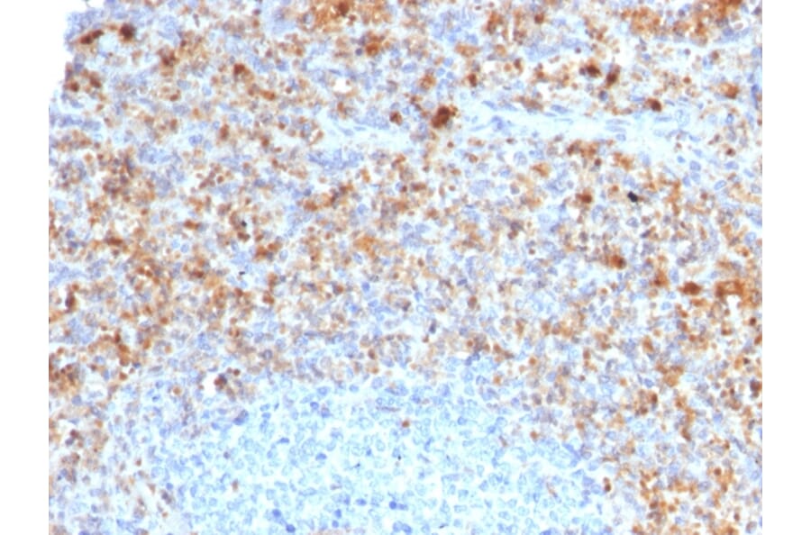 Immunohistochemistry - Anti-CD40L Antibody [CD40LG/2761] (A250702) - Antibodies.com