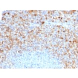 Immunohistochemistry - Anti-CD40L Antibody [CD40LG/2761] (A250702) - Antibodies.com