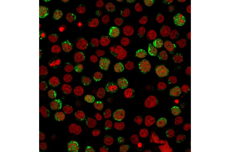 Immunofluorescence - Anti-CD40L Antibody [CD40LG/2761] (A250702) - Antibodies.com