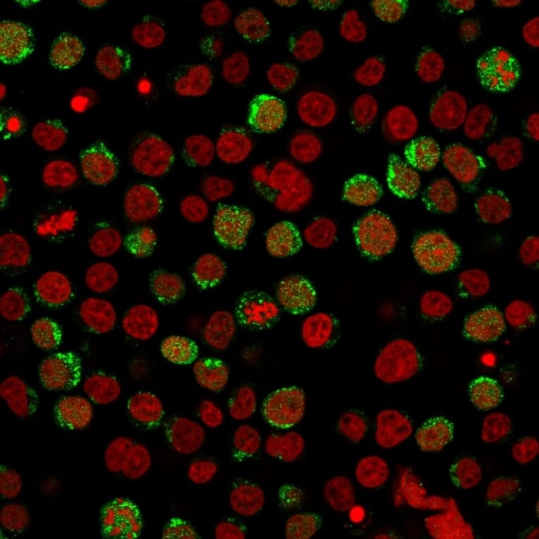 Immunofluorescence - Anti-CD40L Antibody [CD40LG/2761] (A250702) - Antibodies.com