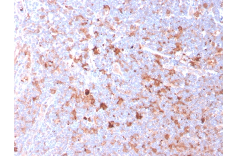 Immunohistochemistry - Anti-CD40L Antibody [CD40LG/2761] (A250702) - Antibodies.com
