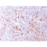 Immunohistochemistry - Anti-CD40L Antibody [CD40LG/2761] (A250702) - Antibodies.com