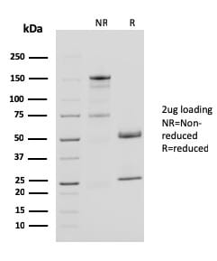 SDS-PAGE analysis of Anti-CD40L Antibody [CD40LG/2761] under non-reduced and reduced conditions; showing intact IgG and intact heavy and light chains, respectively. SDS-PAGE analysis confirms the integrity and purity of the antibody.