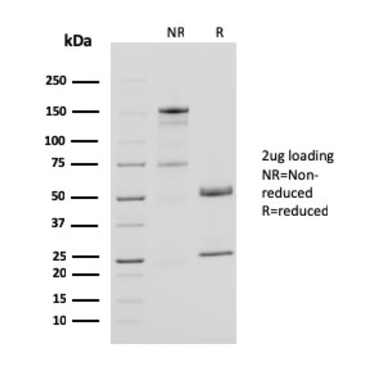 SDS-PAGE - Anti-CD40L Antibody [CD40LG/2761] (A250702) - Antibodies.com