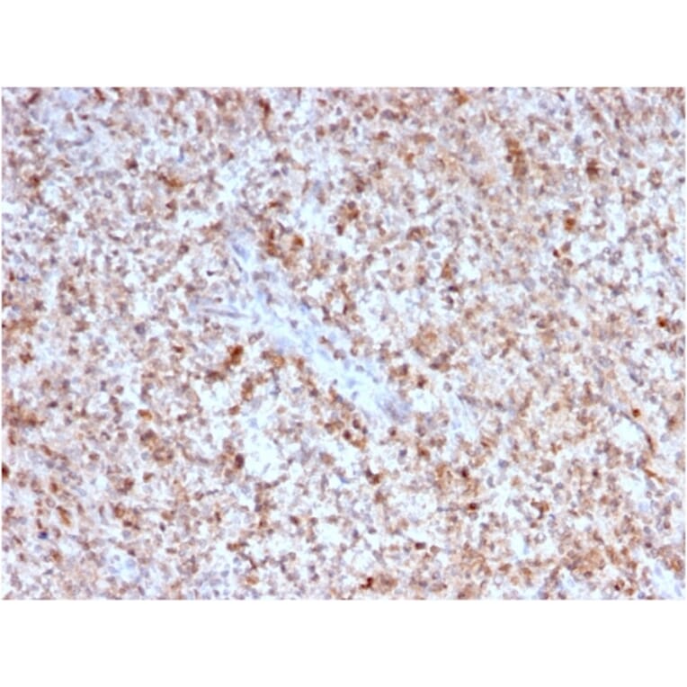 Immunohistochemistry - Anti-CD40L Antibody [CD40LG/2763] (A250703) - Antibodies.com