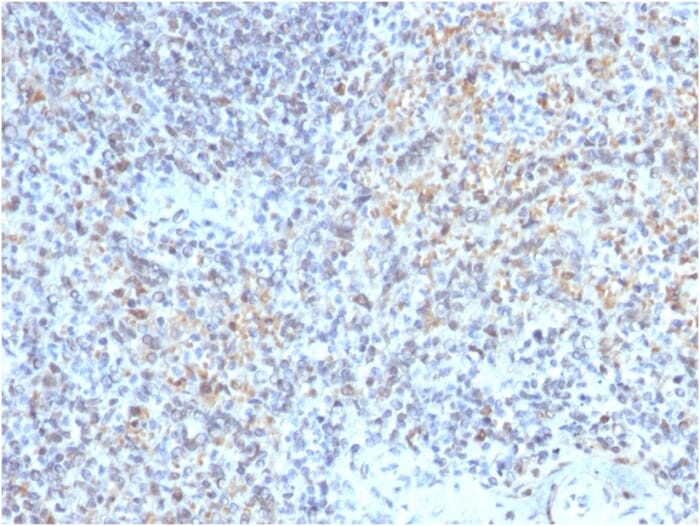 Immunohistochemical analysis of formalin-fixed, paraffin-embedded human spleen using Anti-CD40L Antibody [CD40LG/2763].