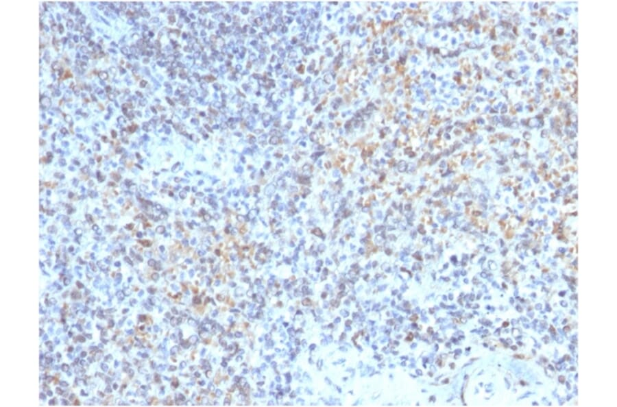 Immunohistochemistry - Anti-CD40L Antibody [CD40LG/2763] (A250703) - Antibodies.com