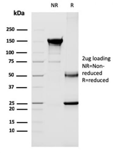 SDS-PAGE analysis of Anti-CD40L Antibody [CD40LG/2763] under non-reduced and reduced conditions; showing intact IgG and intact heavy and light chains, respectively. SDS-PAGE analysis confirms the integrity and purity of the antibody.