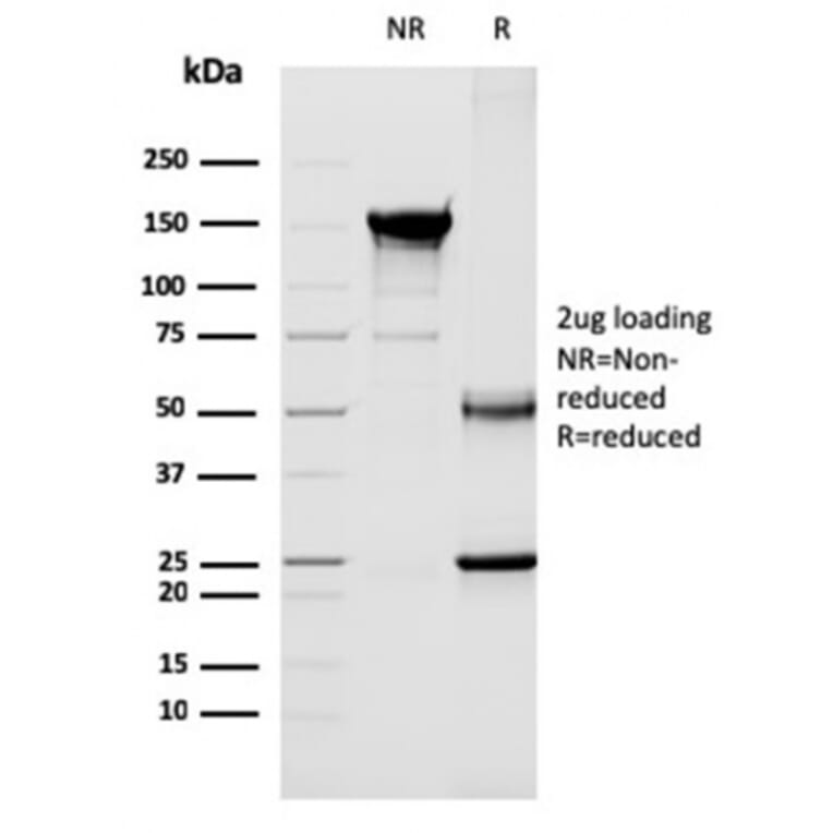 SDS-PAGE - Anti-CD40L Antibody [CD40LG/2763] (A250703) - Antibodies.com