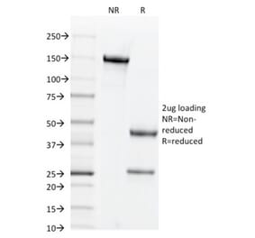 SDS-PAGE - Anti-CD44v3 Antibody [2F10] (A250703) - Antibodies.com